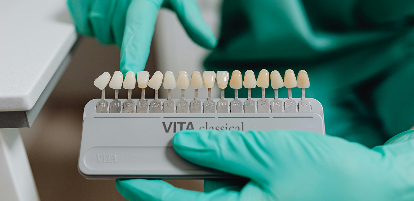 Custom shade dental color palette
