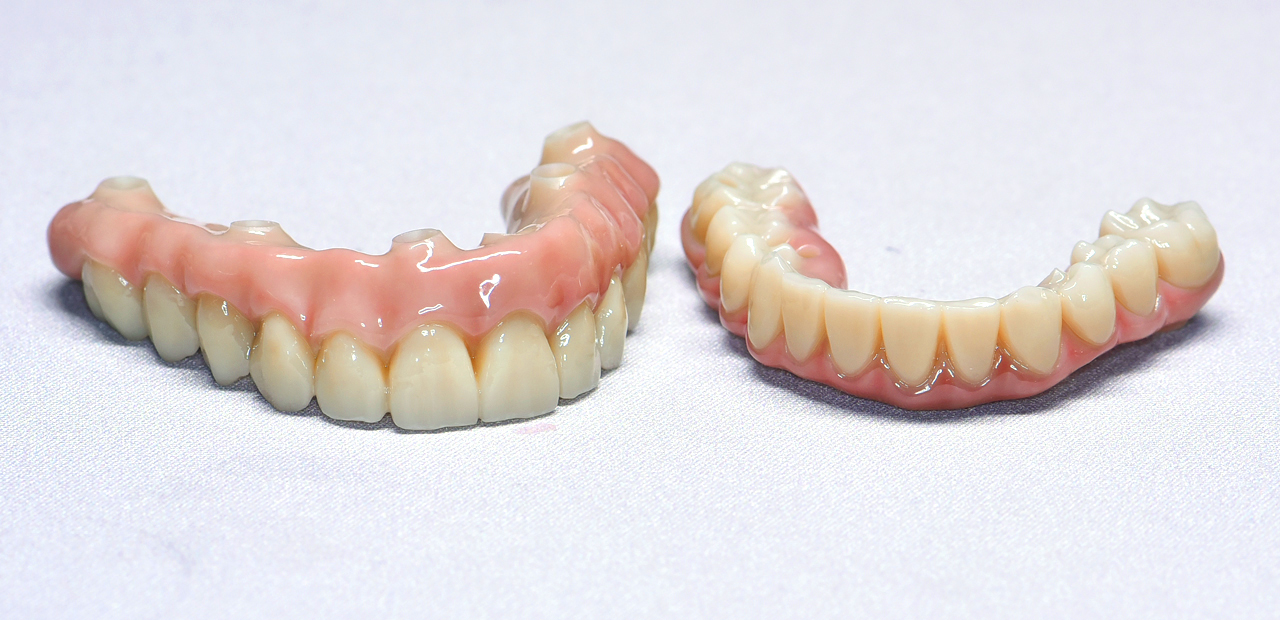zirconia all-on-x
