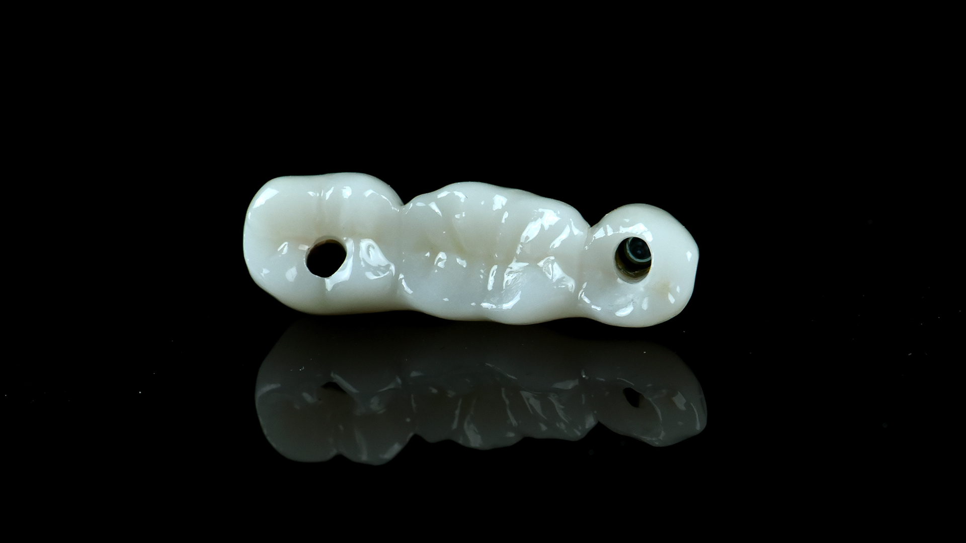 Zirconia bridge on implants